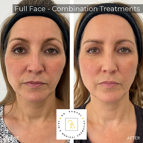 Doctor led skin and medical aesthetics clinic